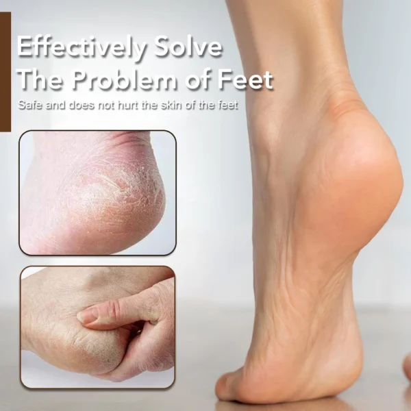 Foot Rasp File - Image 2