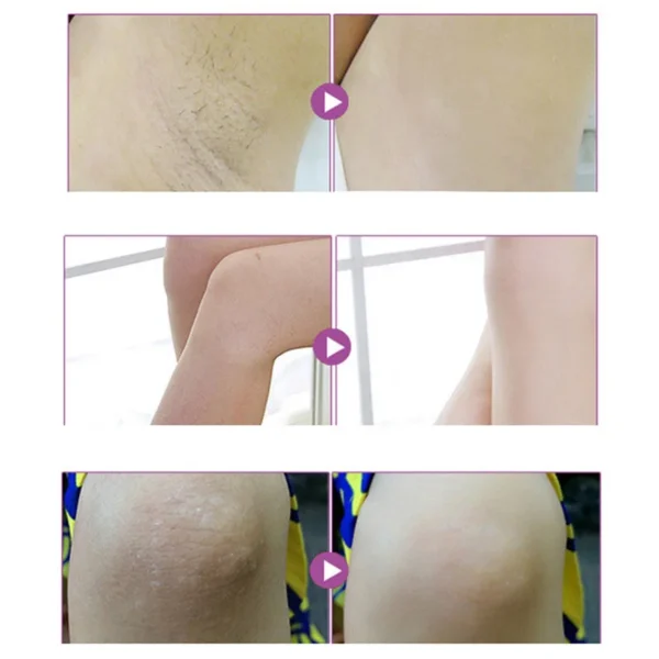Intimate Areas Whitening Cream Sensitive Skin - 50g - Image 3