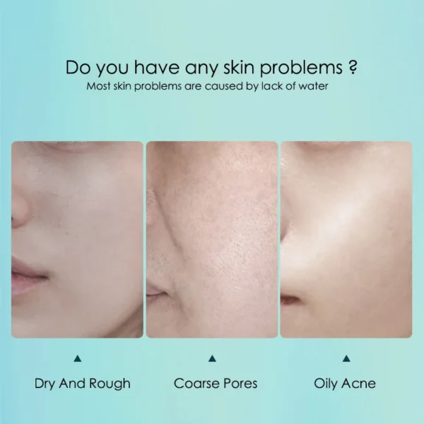 Hyaluronic Acid Hydrating Face Mask - 10 Pieces - Image 3