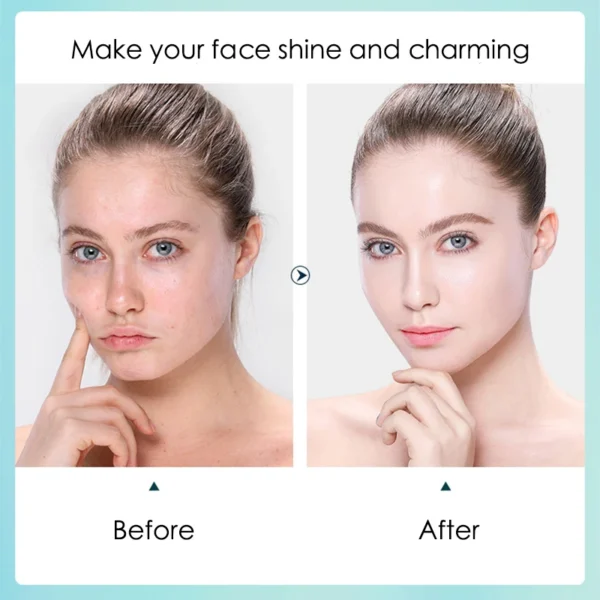Hyaluronic Acid Hydrating Face Mask - 10 Pieces - Image 4